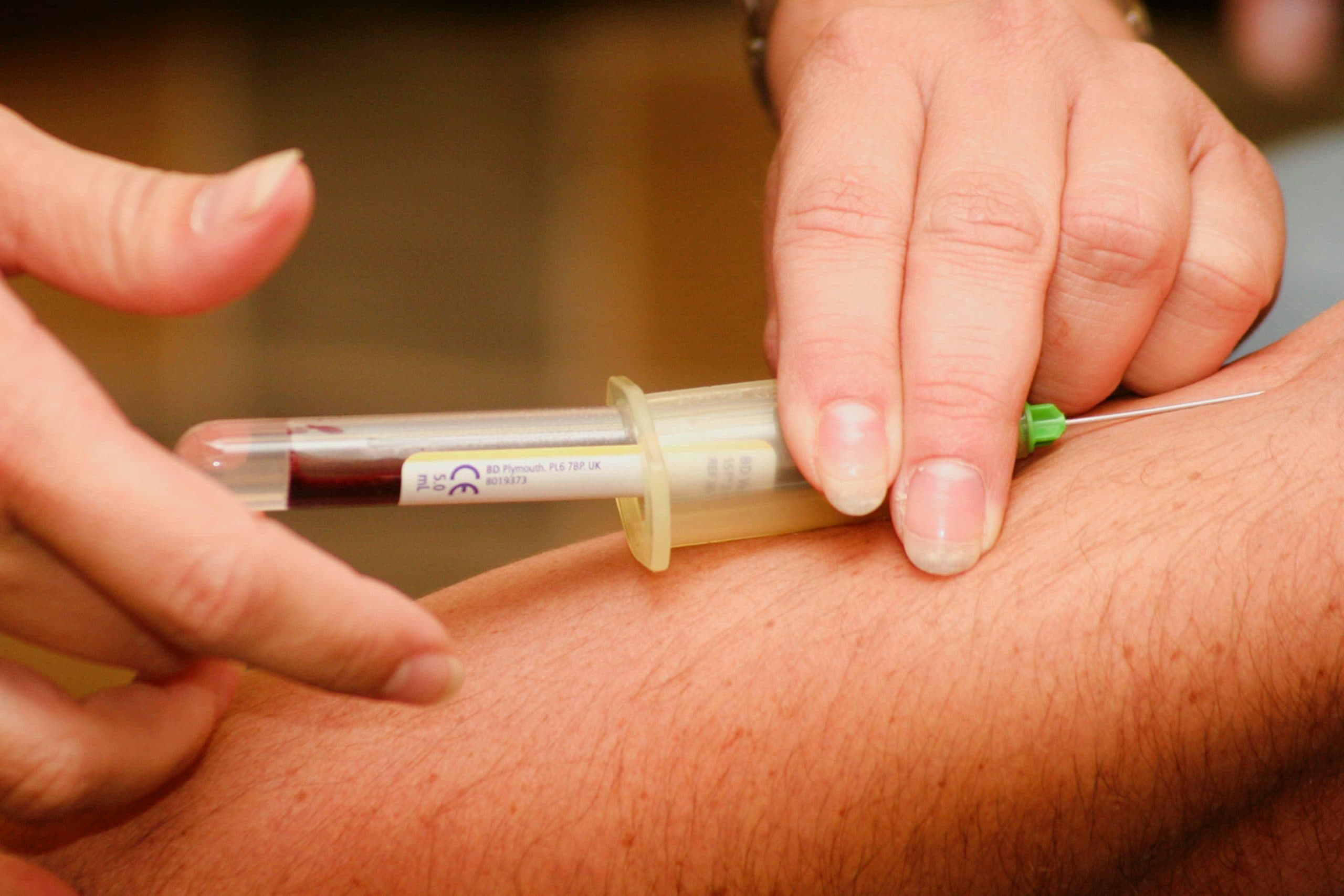 Professor Lee preparing a regenerative joint injection