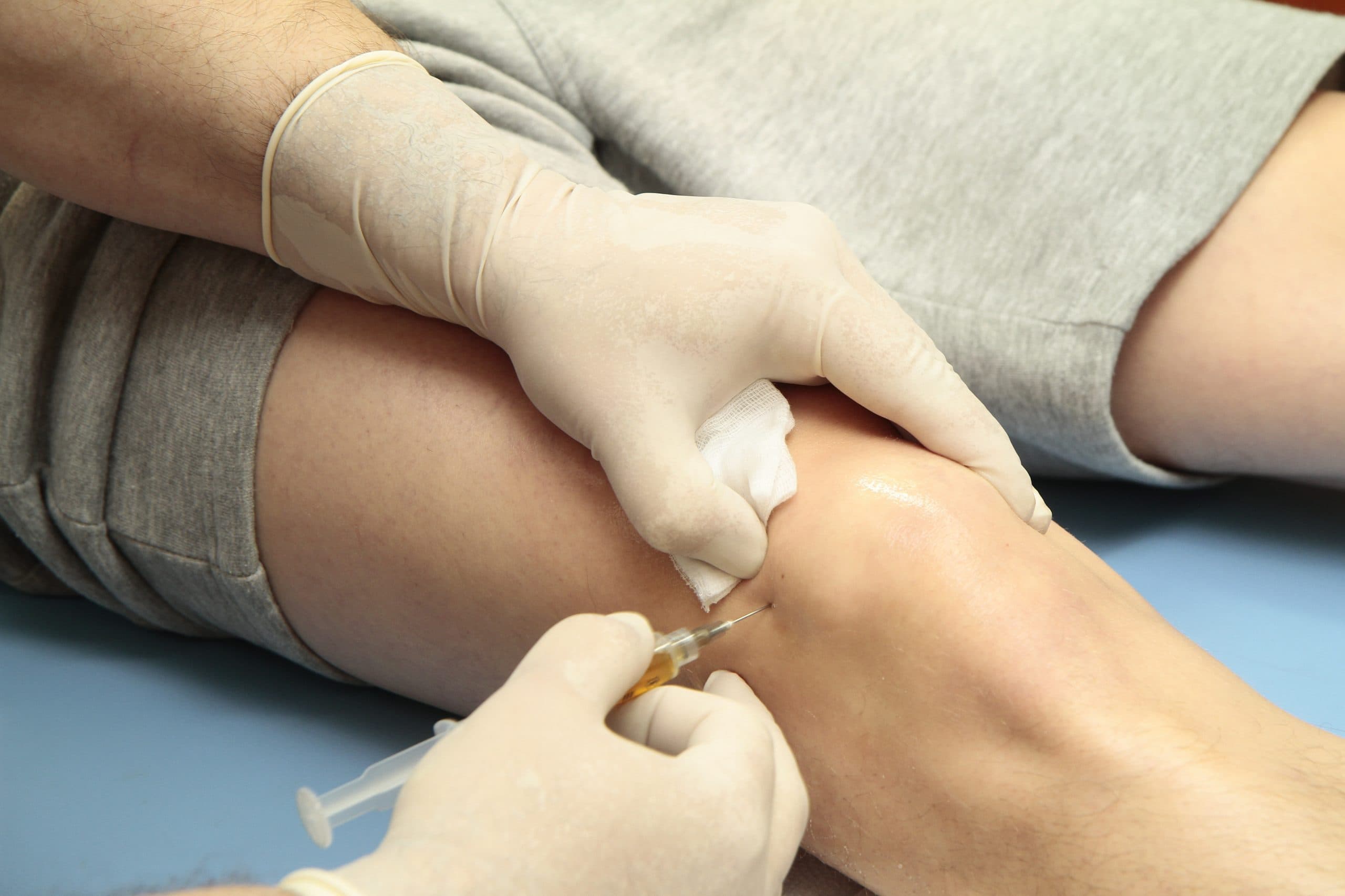 Close-up of Stem Cell / Medicinal Signaling Cell injection treatment