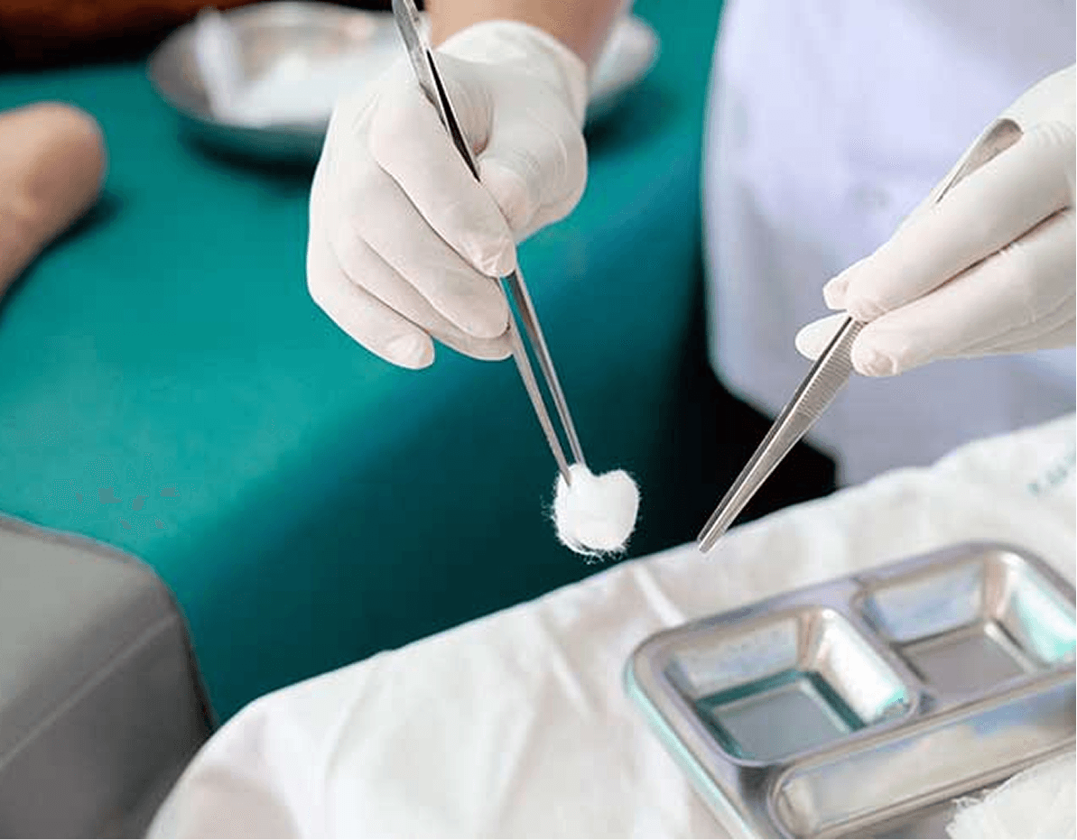 Sterile chair-side handling of the ear cartilage sample